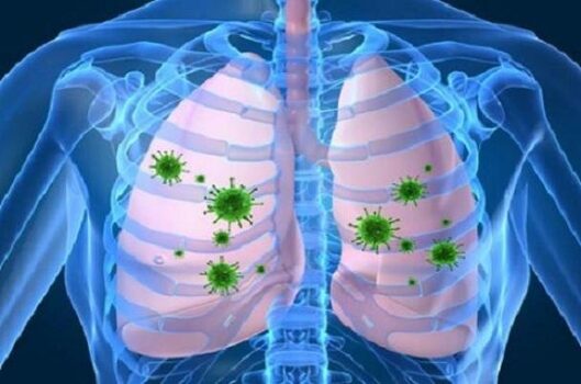 راهی برای کاهش عوارض تنفسی کرونا