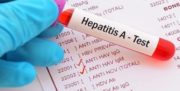 تولید داروهای ژنریک درمان «هپاتیت C» در شرایط تحریم
