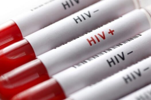 وجود ۲۳۹۰۲ مبتلا به HIV در ایران/ ۸۱ درصد مبتلایان مرد هستند
