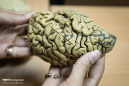 بانک مغز ایران