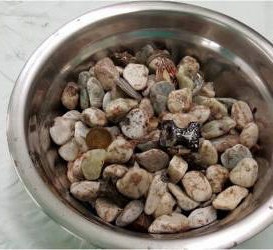 خارج کردن یک کاسه سنگ از شکم مرد استرسی+عکس