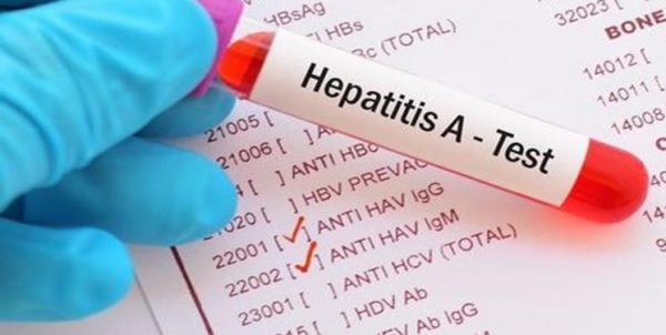 تولید داروهای ژنریک درمان «هپاتیت C» در شرایط تحریم