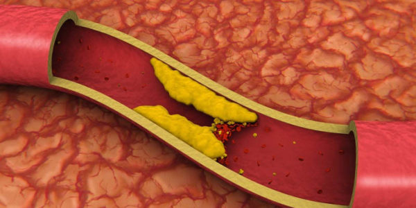 رابطه رژیم غذایی و کلسترول/ برای سلامت قلب چه بخوریم؟